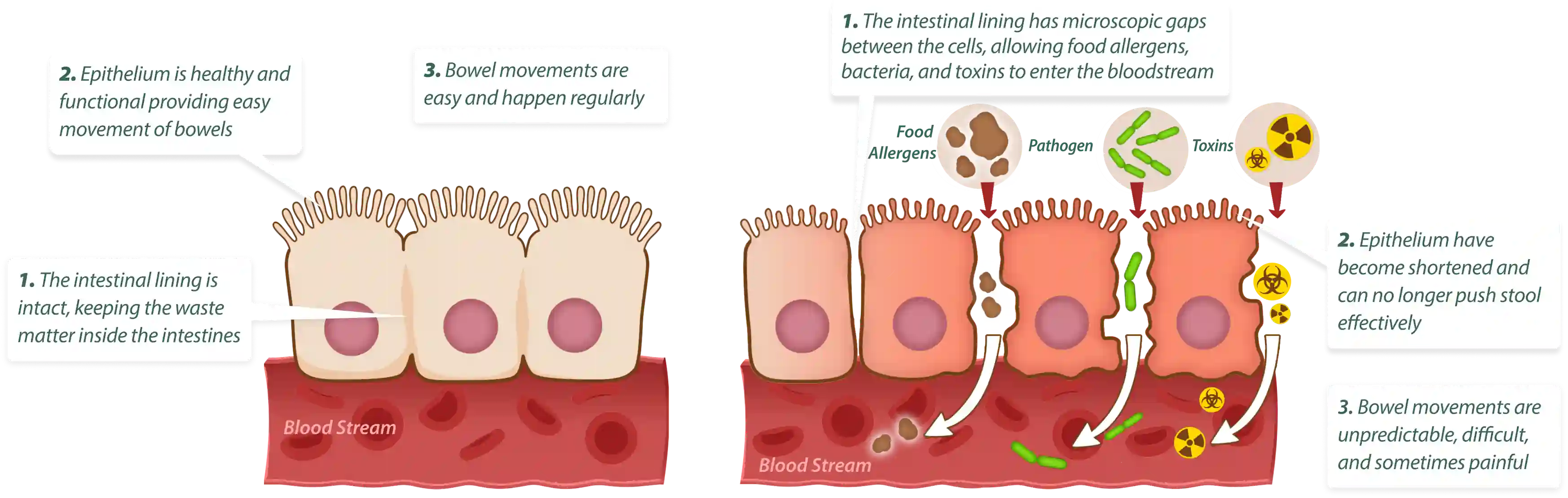 How Emma Relieve works – 3-step gut cleansing and healing process