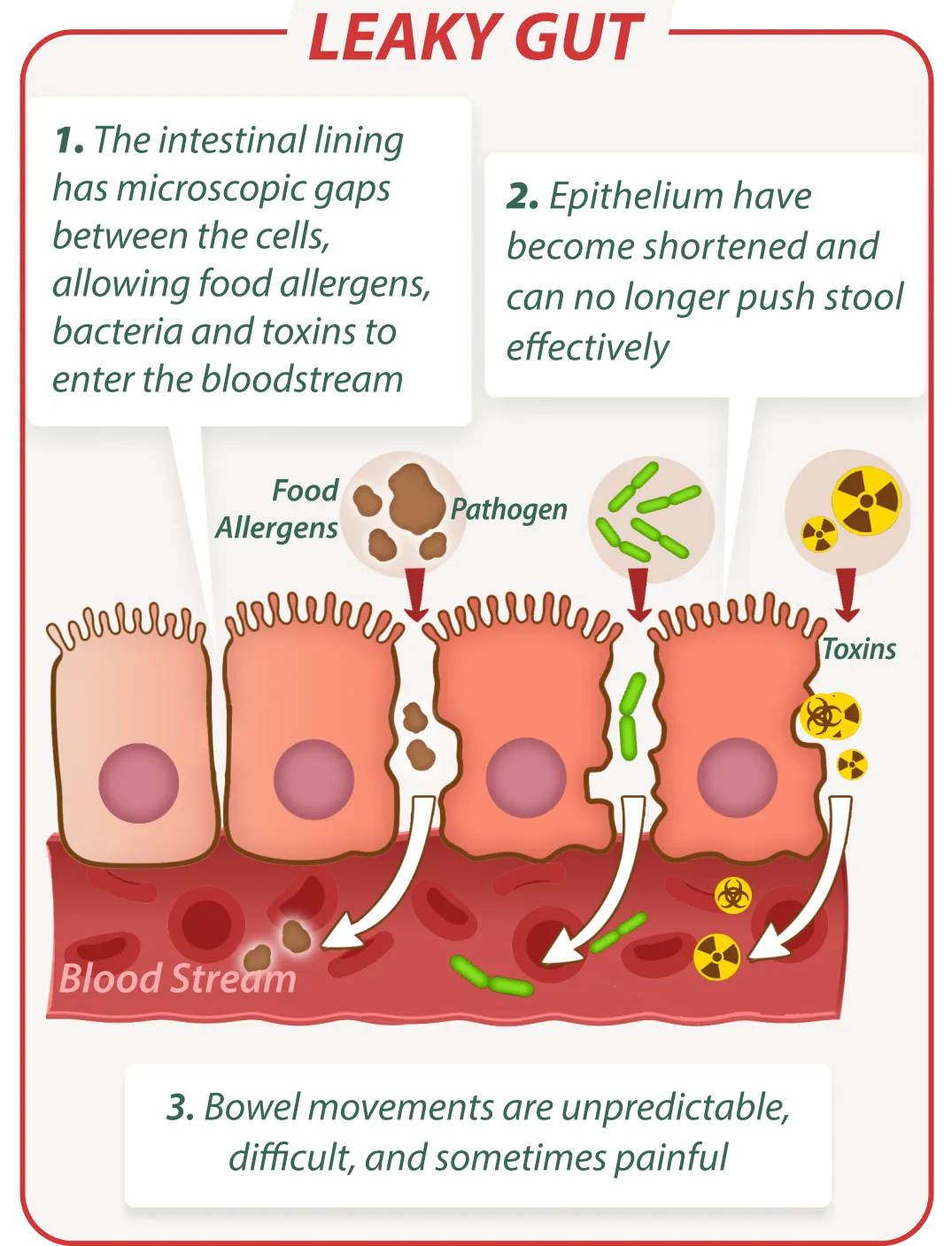 Leaky gut without Emma Relieve – digestive issues illustration